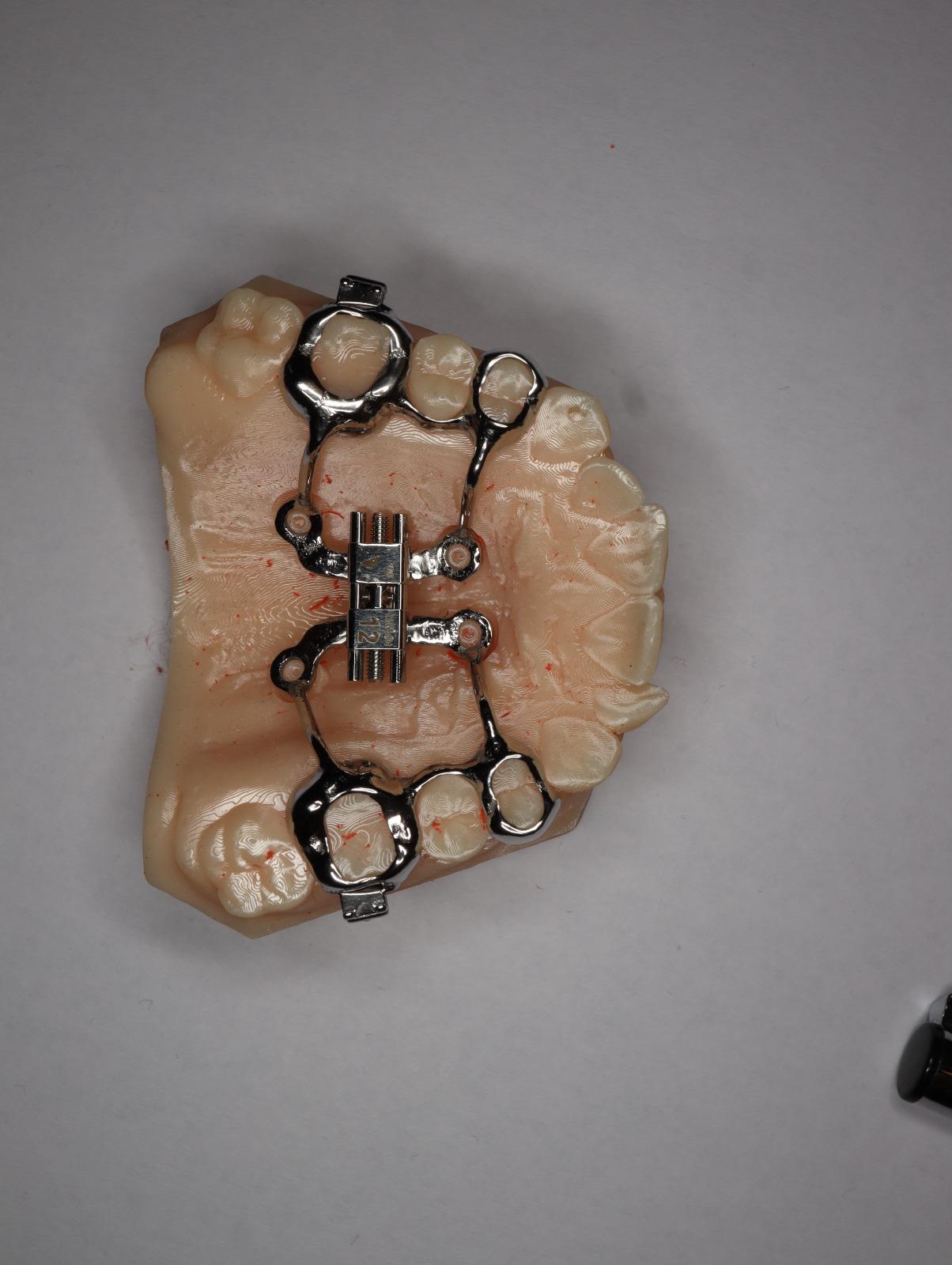 Removable Appliances